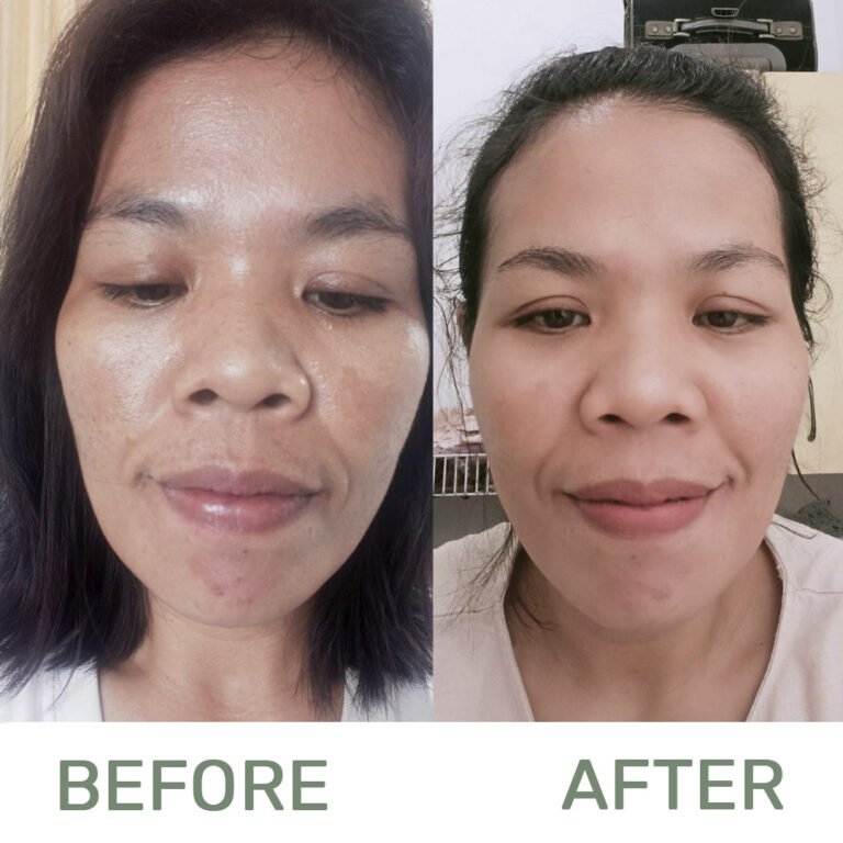 Before-and-after1-1-1.jpg