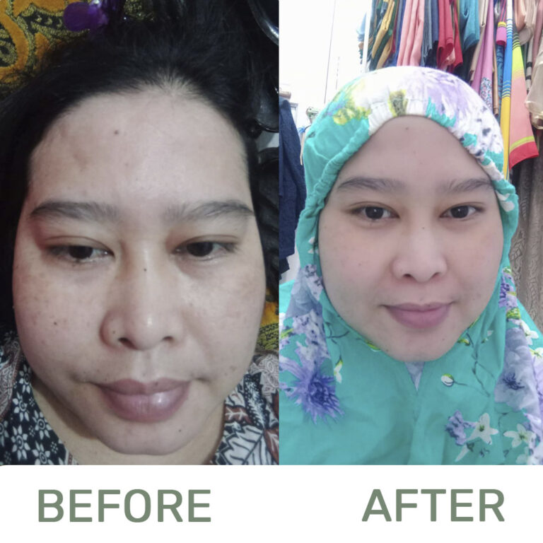 Before-and-after3-1-1.jpg