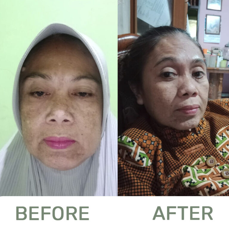 Before-and-after-1-1-1.jpg