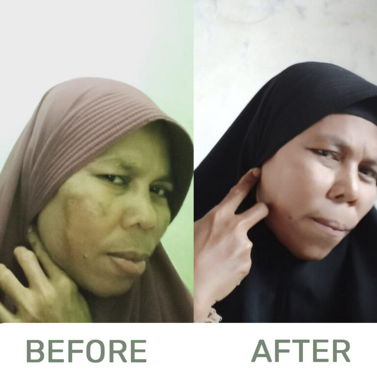 Before-and-after2-1-1.jpg