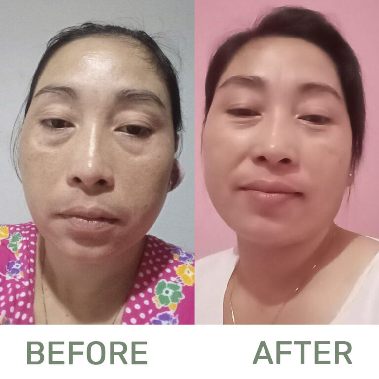 Before-and-after4-1-1-1.jpg