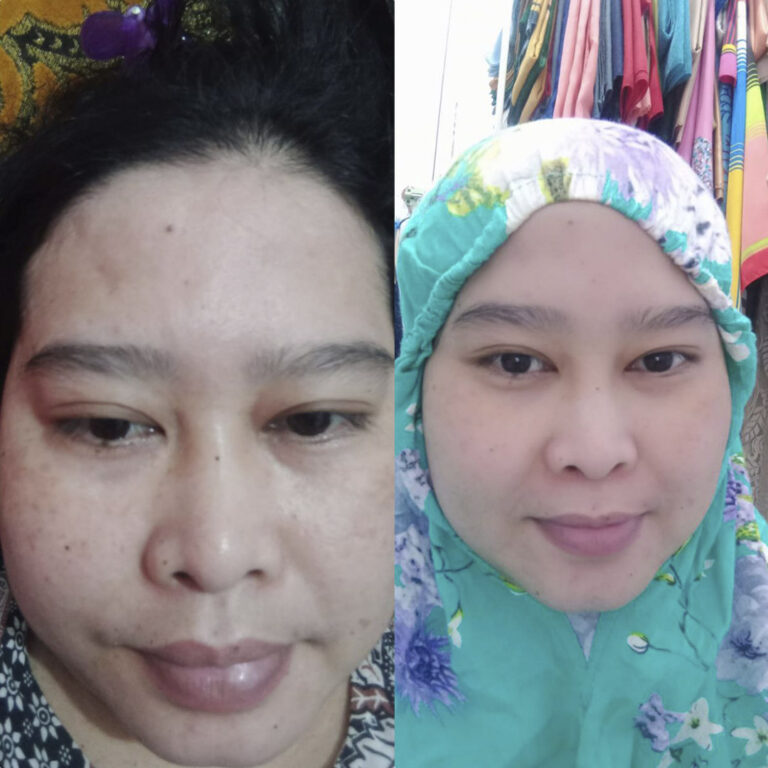 Before-and-after5-1-1-1.jpg
