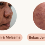 Bundling Serum Kulit Dewasa