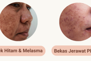 Bundling Serum Kulit Dewasa