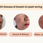 Tiktok Bright Serum Kulit Dewasa