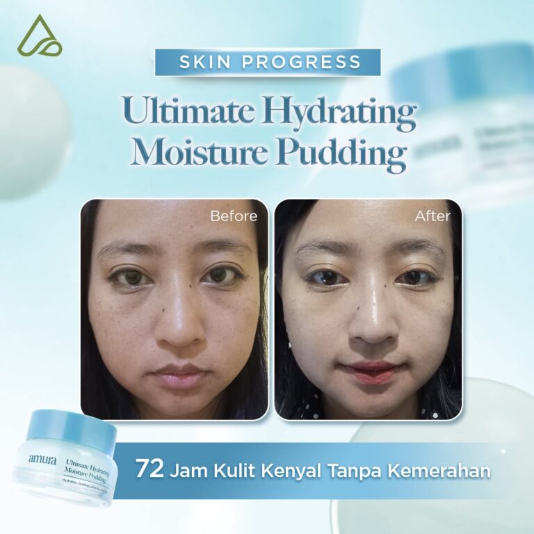 Before After Pudding Hydrating 72 jam kulit kenyal (1)-min