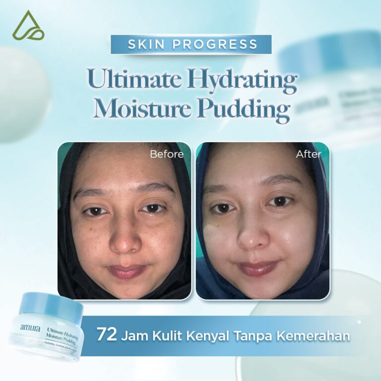 Before After Pudding Hydrating 72 jam kulit kenyal (2)-min