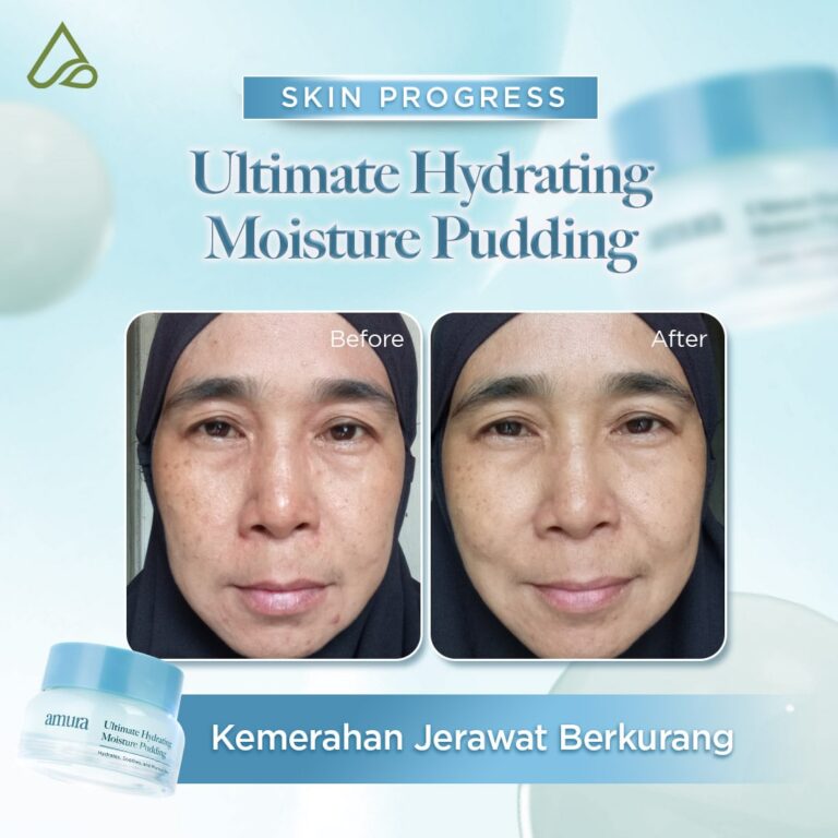 Before After Pudding Hydrating Kemerahan jerawat (1)-min