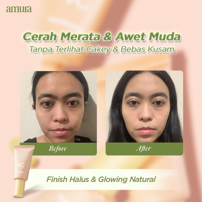 20251202 Before After2-min