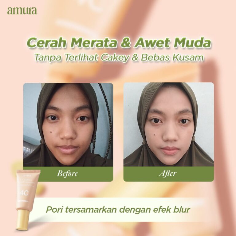 20251202 Before After3-min