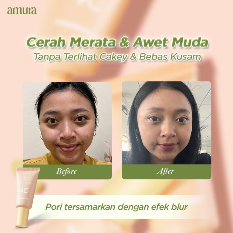 20251202 Before After4-min